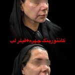 کلینیک زیبایی و جوانسازی پوست و مو الین