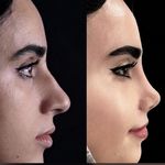 مرکز جراحی زیبایی بینی
