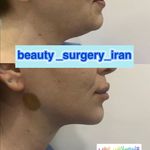 دکتر محمود قهقایی فوق تخصص جراحی پلاستیک