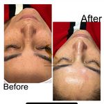 خدمات تخصصی فیشال سارا اسکین بار