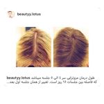 کلینیک پوست و مو و لیزر نیلوفر آبی