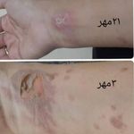 مرکز مشاورتخصصی پوست مو و فیشیالیست