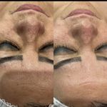 فیشال، پاکسازی و کربوکسی صبا جعفری