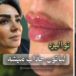 کلینیک زیبایی الیزه