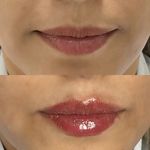 مرکز زیبایی و لیزر دکتر اخوان