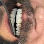 لابراتوار دندانسازی تاج