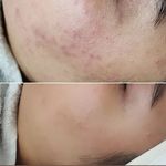 فیشیال و پاکسازی پوست عاطفه سهیلی