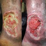 کارشناس زخم و متخصص کیوم تراپی بهرامی فر