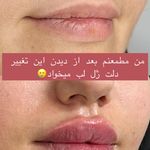 کلینیک زیبایی و جوانسازی پوست و مو الین