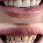 مرکز دندانپزشکی و دندانسازی اشراق