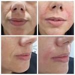 کیلینیک زیبایی الا