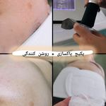 استودیو پوست هلیا فیشیال و پاکسازی تخصصی