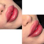 میکروبلیدینگ و ارایش دائم و شیدینگ لب