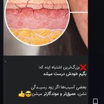 زیبایی بی پایان
