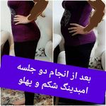 طب سنتی عامری (حجامت و بادکش)