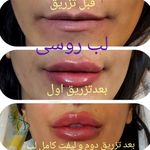 کلینیک پوست و مو و لیزر نیلوفر آبی