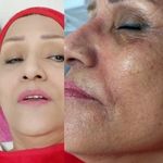 سالن پاکسازی پوست وفیشیال صورت زیبارو