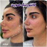 کلینیک لیزر و زیبایی دایان