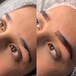 مرکز فوق تخصصی میکروبلیدینگ ابرو هانی