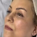 کلینیک زیبایی الماس کاملا اقساطی