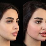 کلینیک زیبایی الماس کاملا اقساطی