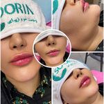 کلینیک زیبایی و پوست دکتر سورین