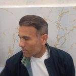 کاشت مو سر ابرو اردبیل و پارس آباد مرادی