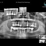 مطب دندانپزشکی دکتر فاطمه محمودی افصح