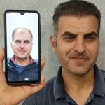 کلینیک زیبایی و کاشت مو تخصصی دنسا