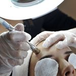 جوانسازی پوست،زیبائی و فیشیال دکتر امینی