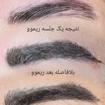 بهترین ریمووکار و میکرو،شیدلب نور ربیع