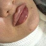 کلینیک زیبایی و لیزر و لاغری الین