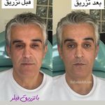 کلینیک زیبایی و لیزر دکتر آزاده اسماعیلی