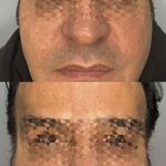 مطب زیبایی آرا