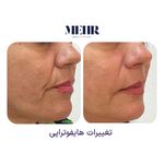 کلینیک زیبایی مهر