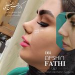 فوق تخصص جراحی زیبایی و بینی دکتر فتحی