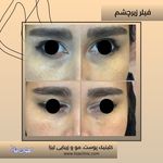 مطب پوست مو زیبایی فردوس شرق