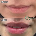 کلینیک پوست،زیبایی ولیزر وکاشت مو الماس