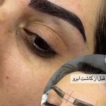 کلینیک زیبایی پوست و مو آتریسا