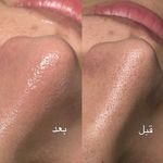 پاکسازی پوست و مو مهسام