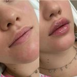 کلینیک پوست و زیبایی ژیلاوَش