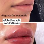 مطب پوست مو زیبایی و لاغری ژن شیک
