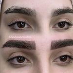خدمات فوق تخصصی میکرو ماندانا