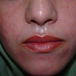 کلینیک زیبایی پوست و مو آتریسا