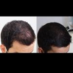 مرکز پوست و لیزر  سایناشور آمریکا دلدار