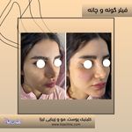 مطب پوست مو زیبایی فردوس شرق