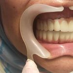 مطب ایمپلنت دکتر نیما شفیعی