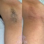 مرکز لیزر و کلینیک زیبایی آروین