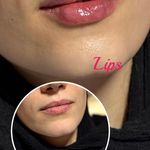 کلینیک زیبایی و مرکز لیزر هانیسا
