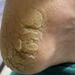 خدمات‌تخصصی اسپاپدیکورکفسابی‌